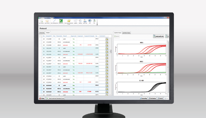 [Translate to Spanish:] EURORealTime Analysis